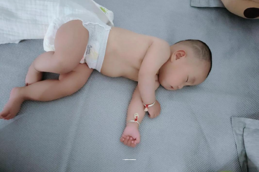 广州代怀供卵公司宝宝头上长痱子